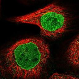 Immunocytochemistry/Immunofluorescence: DTX2 Antibody [NBP2-13941] - Staining of human cell line A-431 shows positivity in nucleus but not nucleoli and nuclear membrane.