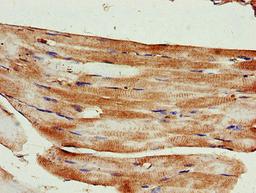 Immunohistochemistry of paraffin-embedded human skeletal muscle tissue using CSB-PA613582LA01HU at dilution of 1:100