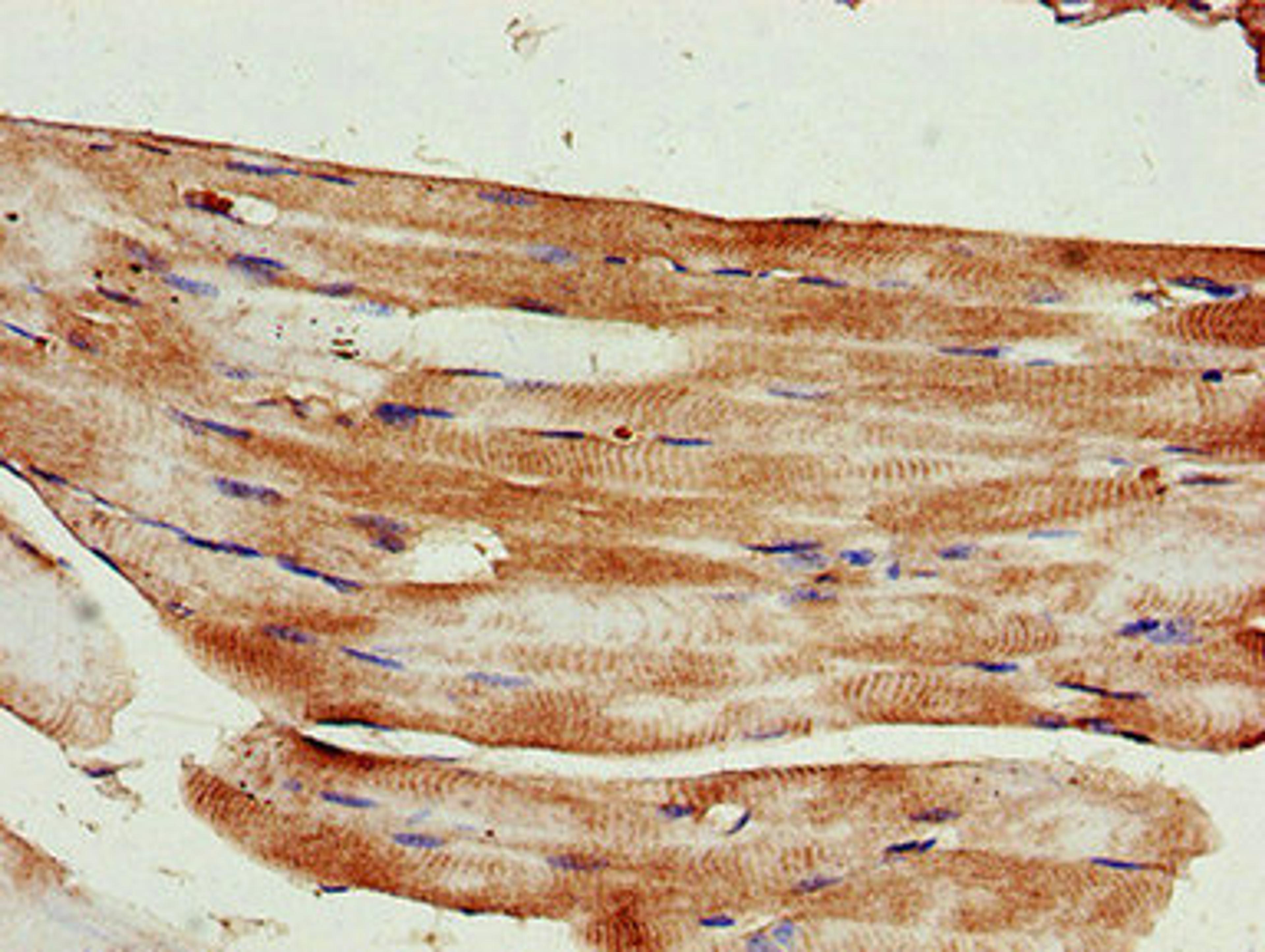 Immunohistochemistry of paraffin-embedded human skeletal muscle tissue using CSB-PA613582LA01HU at dilution of 1:100
