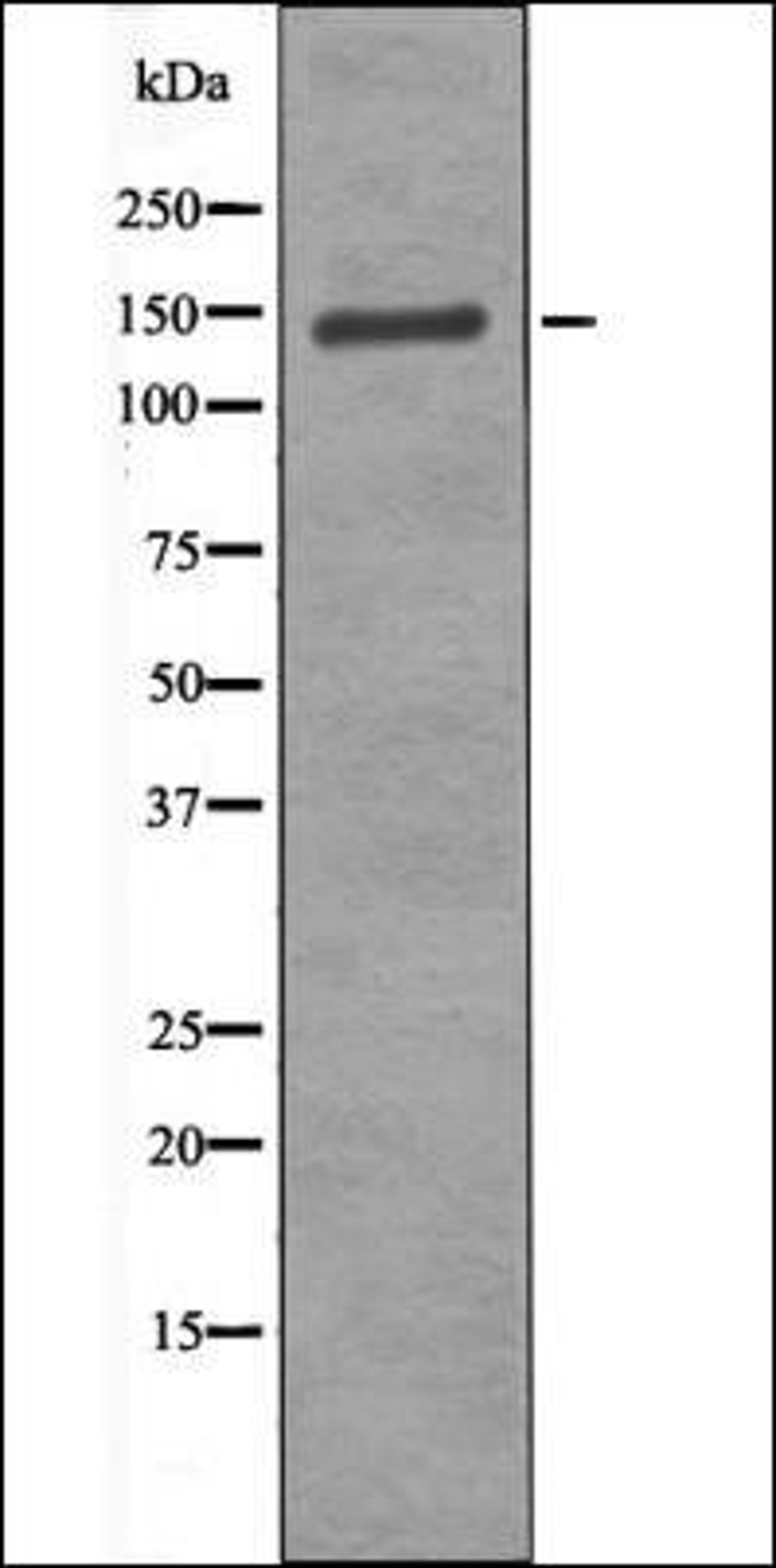 Western blot analysis of HuvEc whole cell lysates using KIT -Phospho-Ser746- antibody