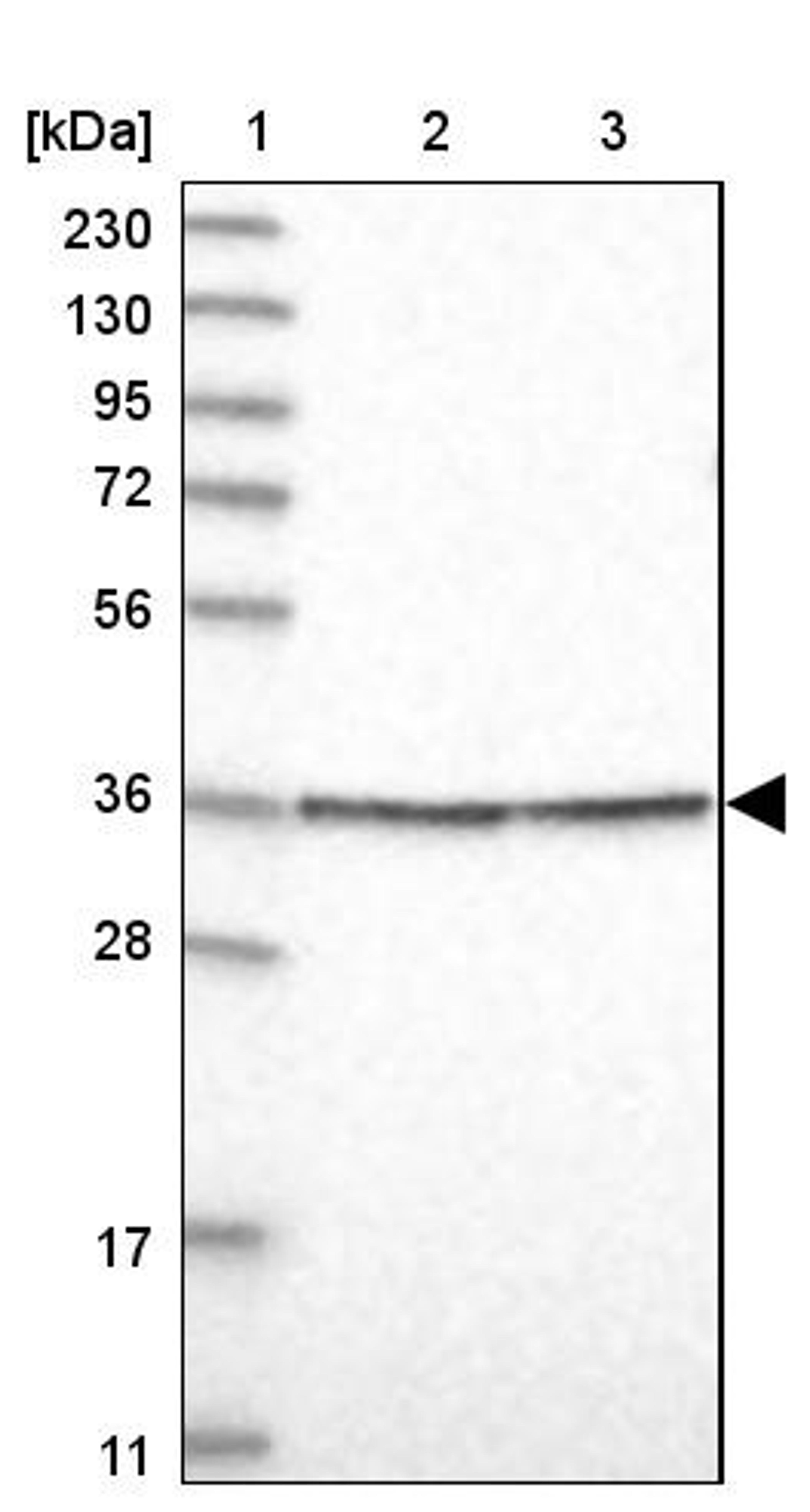 Western Blot: RAD54B Antibody [NBP1-83416] - Lane 1: Marker [kDa] 230, 130, 95, 72, 56, 36, 28, 17, 11<br/>Lane 2: Human cell line RT-4<br/>Lane 3: Human cell line U-251MG sp