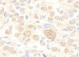 Detection of human FUSIP1 by immunohistochemistry.