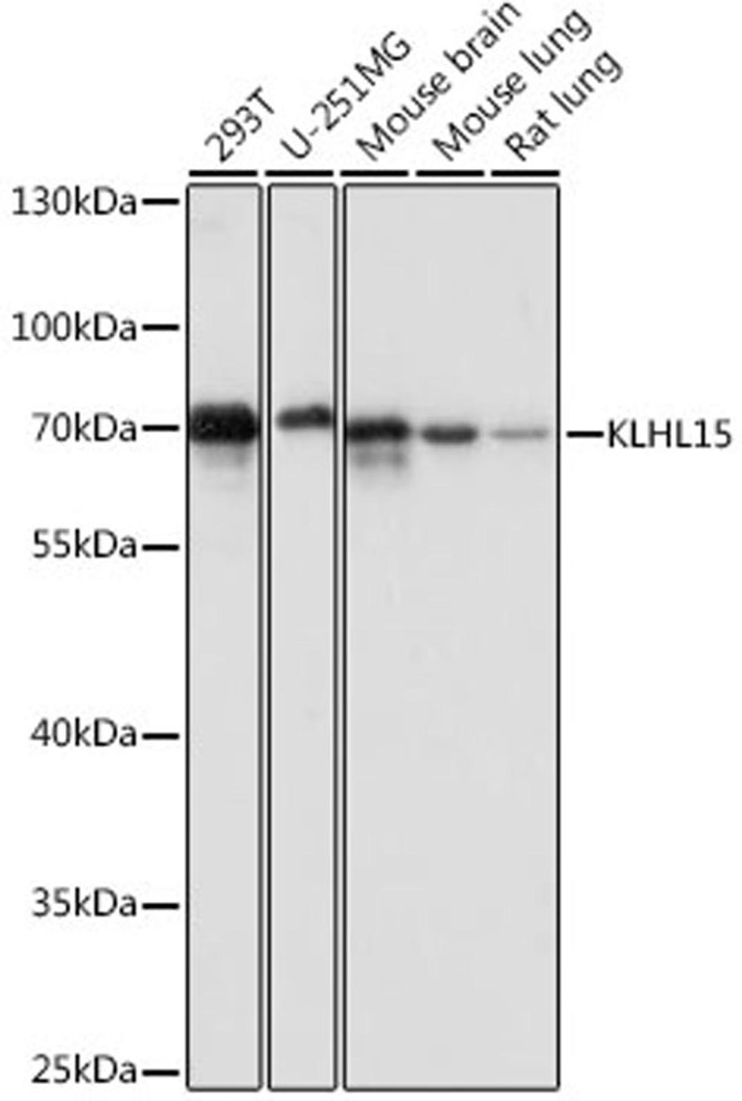 Western blot - KLHL15 antibody (A16574)