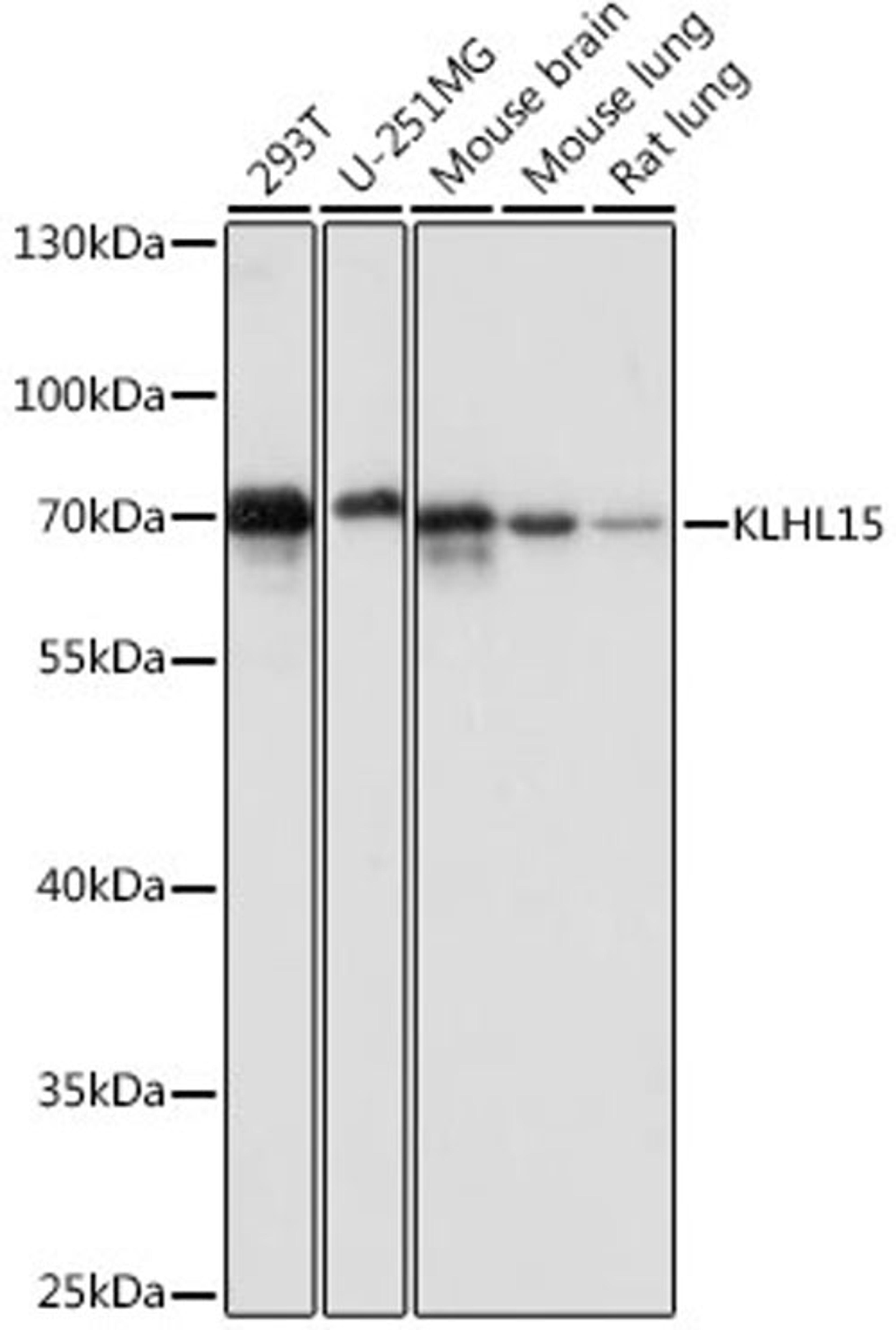 Western blot - KLHL15 antibody (A16574)