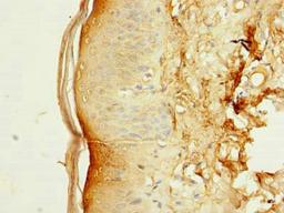Immunohistochemistry of paraffin-embedded human skin tissue using CSB-PA889118HA01HU at dilution of 1:100
