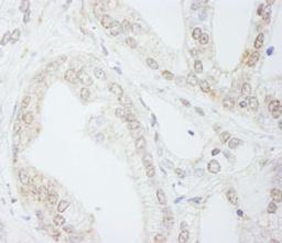 Detection of human METTL3/MT-A70 by immunohistochemistry.