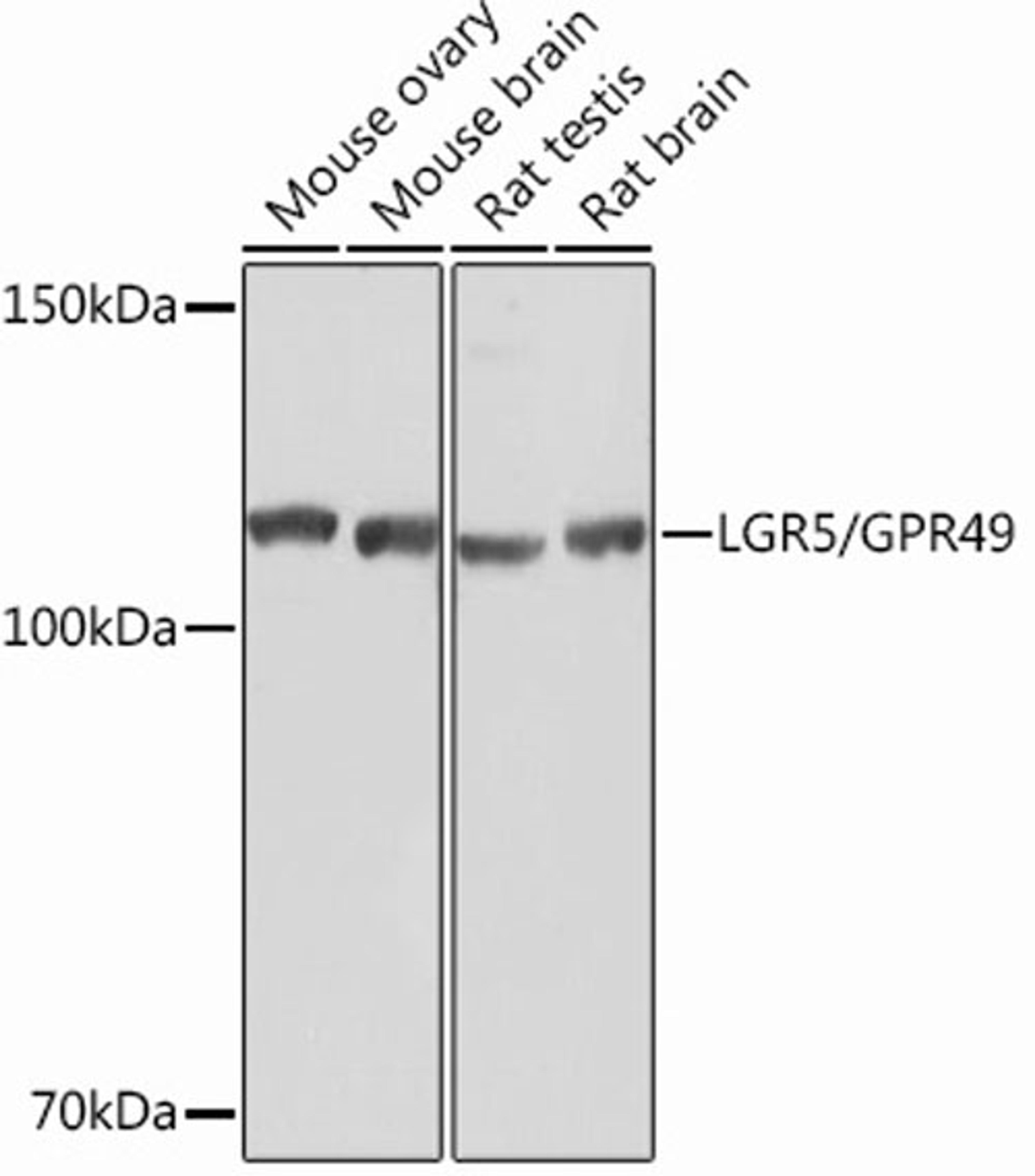 Western blot - LGR5/GPR49 Rabbit mAb (A12327)