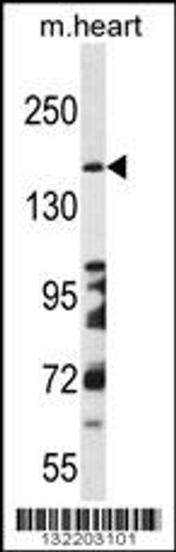 Western blot analysis in mouse heart tissue lysates (35ug/lane).