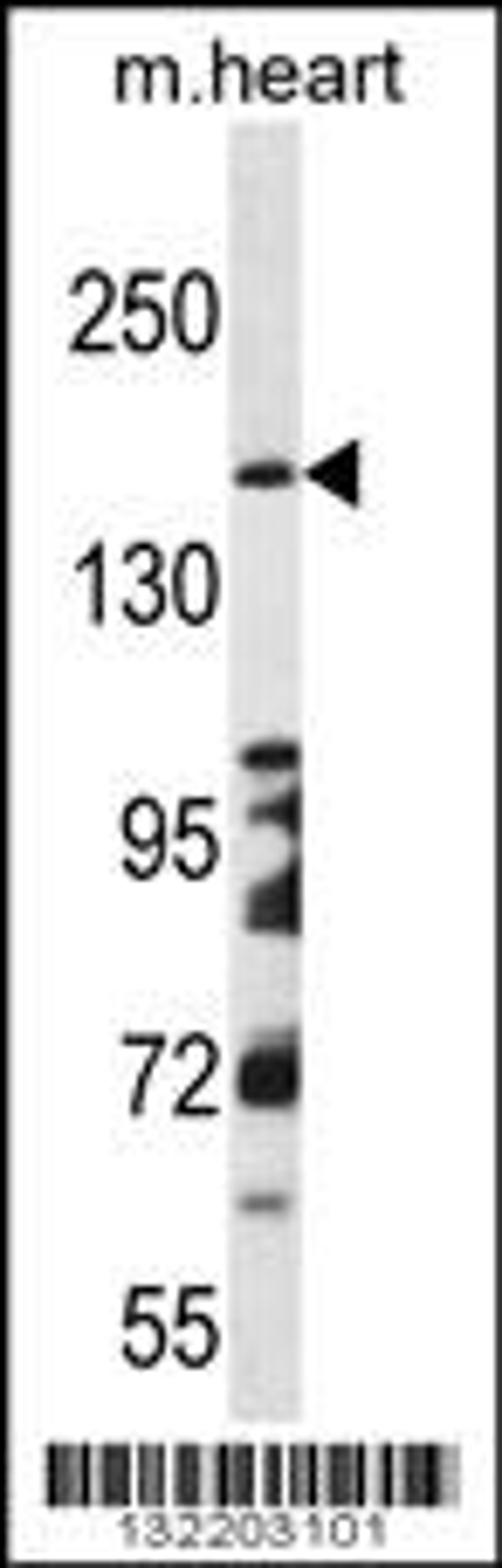 Western blot analysis in mouse heart tissue lysates (35ug/lane).