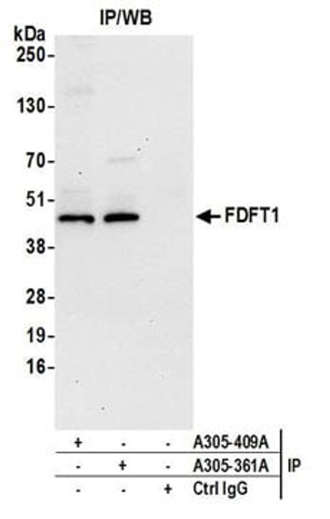 Detection of human FDFT1 by western blot of immunoprecipitates.