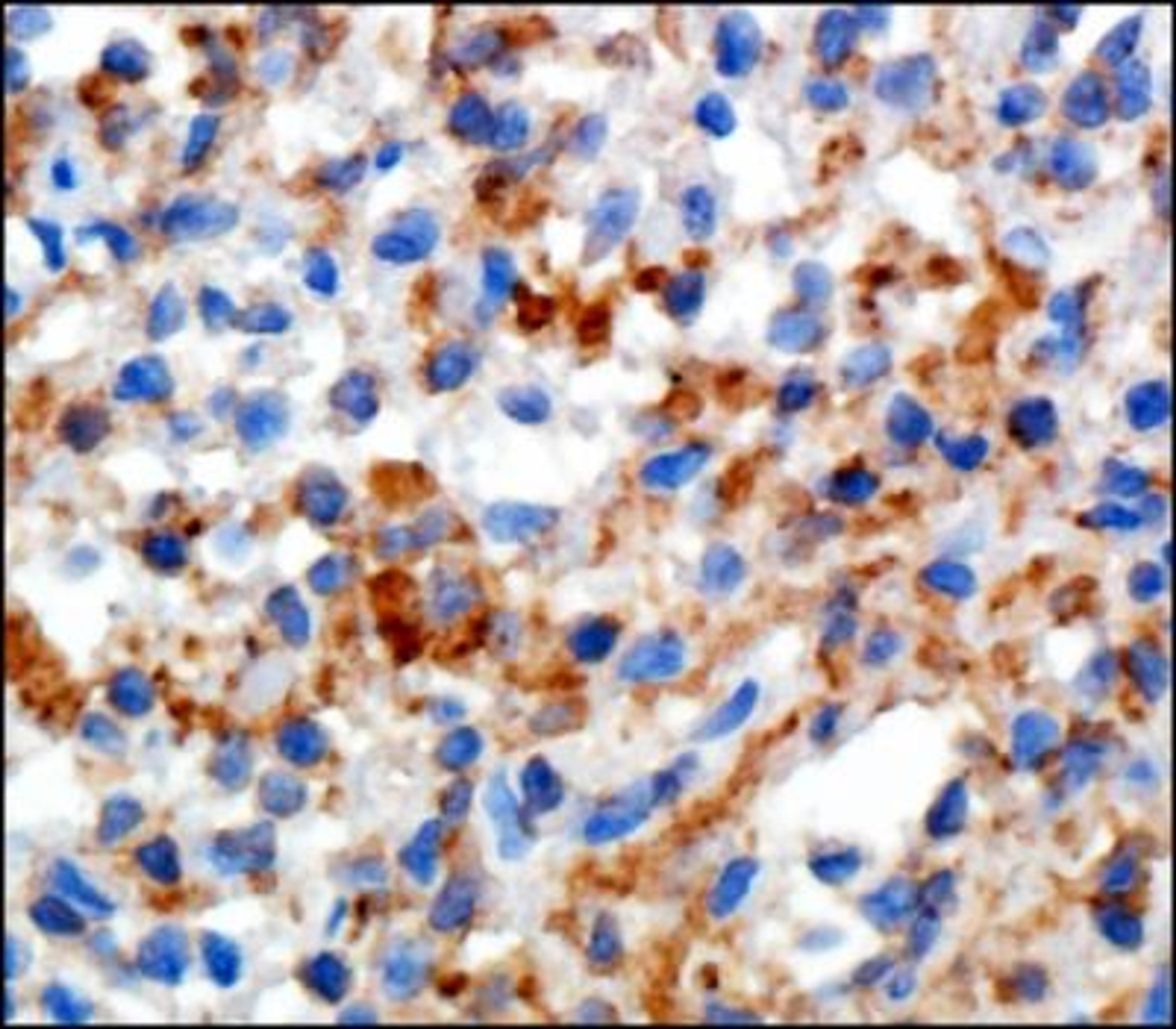 Immunohistochemistry-Paraffin: Sialoadhesin Antibody (HSn 7D2) [NB600-534] - IHC staining of Sialoadhesin in human spleen using DAB with hematoxylin counterstain.