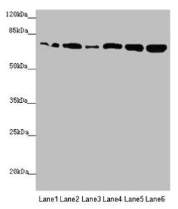 Western blot. All lanes: KIZ antibody at 2.89µg/ml. Lane 1: HepG2 whole cell lysate. Lane 2: A549 whole cell lysate. Lane 3: CEM whole cell lysate. Lane 4: Hela whole cell lysate. Lane 5: Jurkat whole cell lysate. Lane 6: 293T whole cell lysate. Secondary. Goat polyclonal to rabbit IgG at 1/10000 dilution. Predicted band size: 76, 63, 70, 74, 60 kDa. Observed band size: 76 kDa