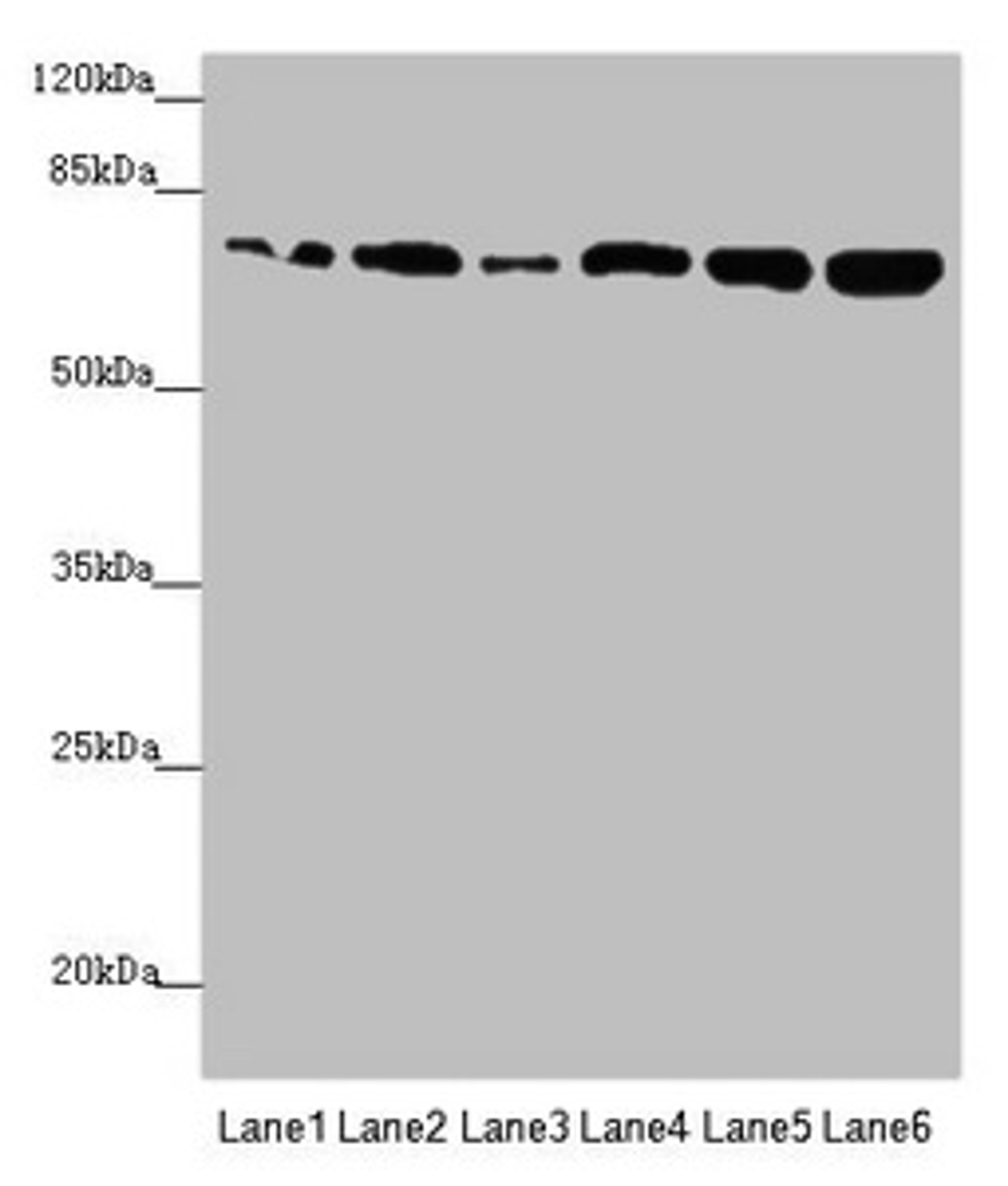 Western blot. All lanes: KIZ antibody at 2.89µg/ml. Lane 1: HepG2 whole cell lysate. Lane 2: A549 whole cell lysate. Lane 3: CEM whole cell lysate. Lane 4: Hela whole cell lysate. Lane 5: Jurkat whole cell lysate. Lane 6: 293T whole cell lysate. Secondary. Goat polyclonal to rabbit IgG at 1/10000 dilution. Predicted band size: 76, 63, 70, 74, 60 kDa. Observed band size: 76 kDa