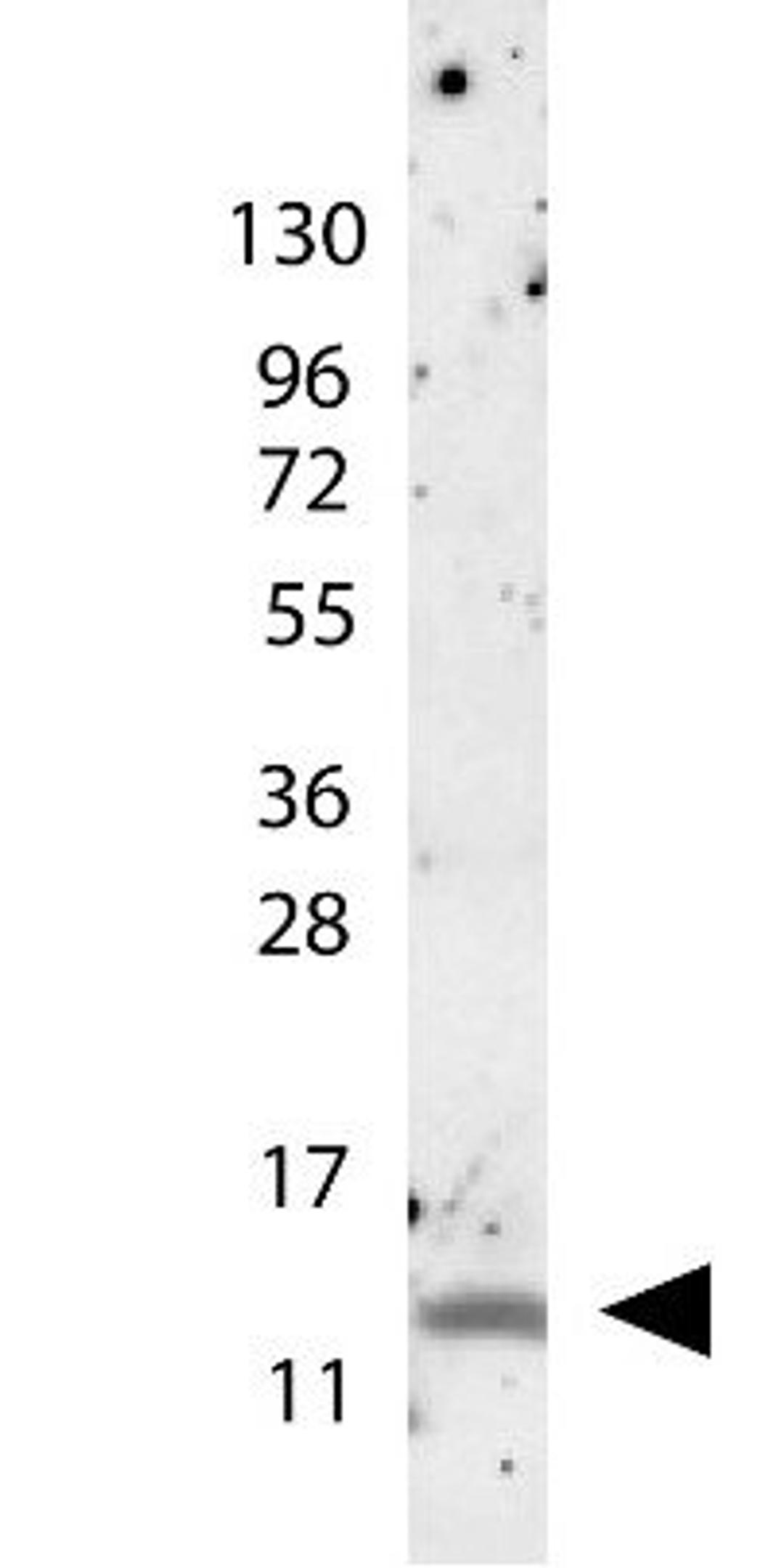 Western blot analysis of molecular weight markers are also shown (left) using MIP-1 beta antibody