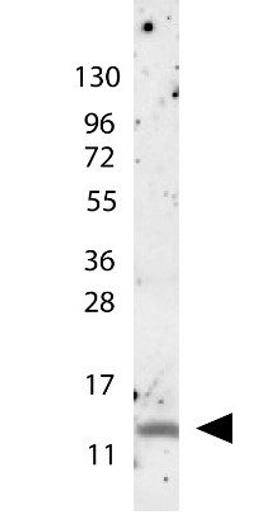 Western blot analysis of molecular weight markers are also shown (left) using MIP-1 beta antibody