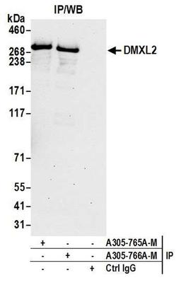 Detection of human DMXL2 by WB of IP.