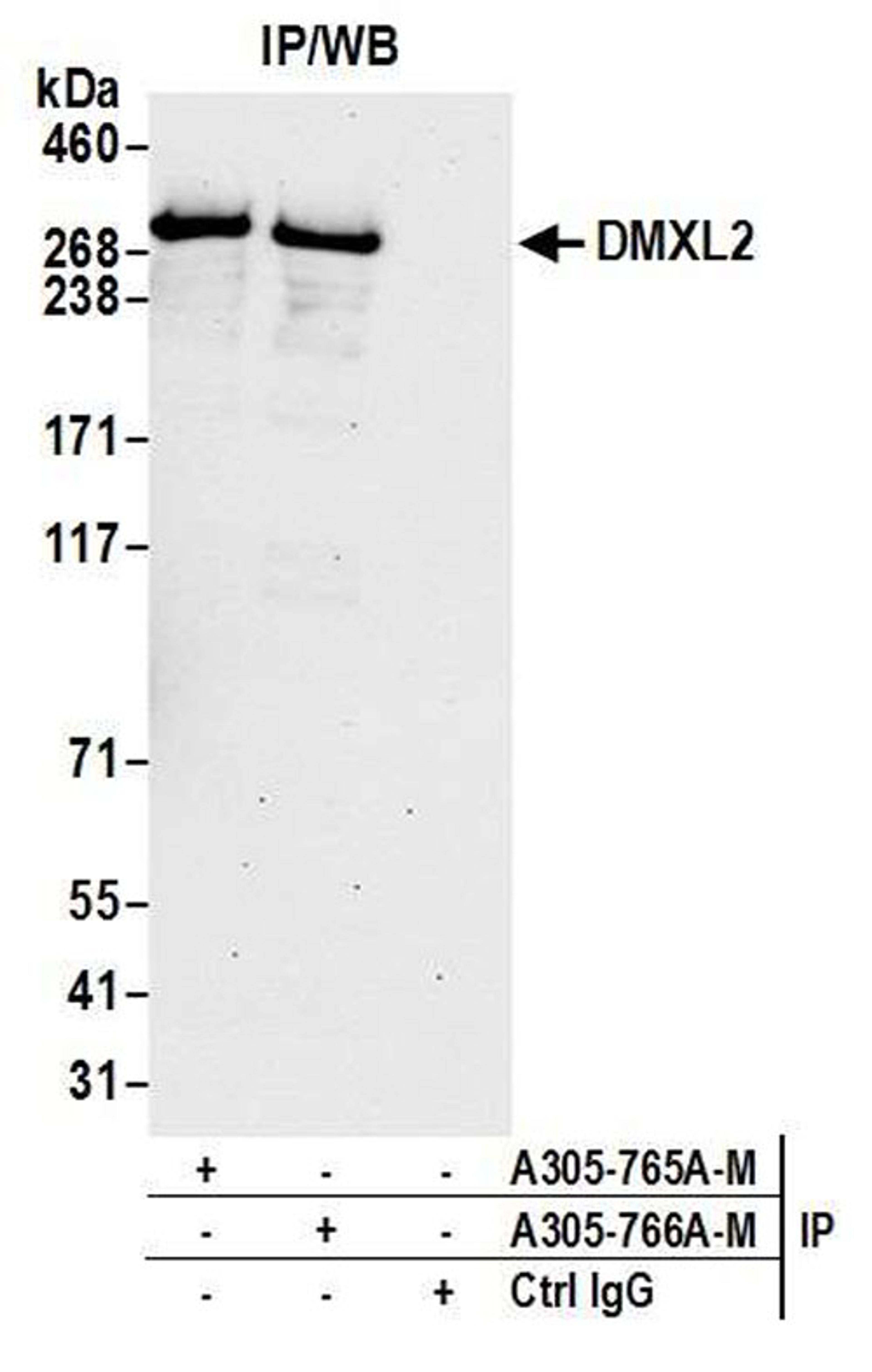 Detection of human DMXL2 by WB of IP.