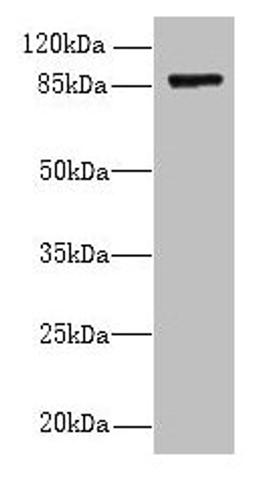 Western blot. All lanes: FSCB antibody at 1.5µg/ml + Mouse liver tissue. Secondary. Goat polyclonal to rabbit IgG at 1/10000 dilution. Predicted band size: 88 kDa. Observed band size: 88 kDa