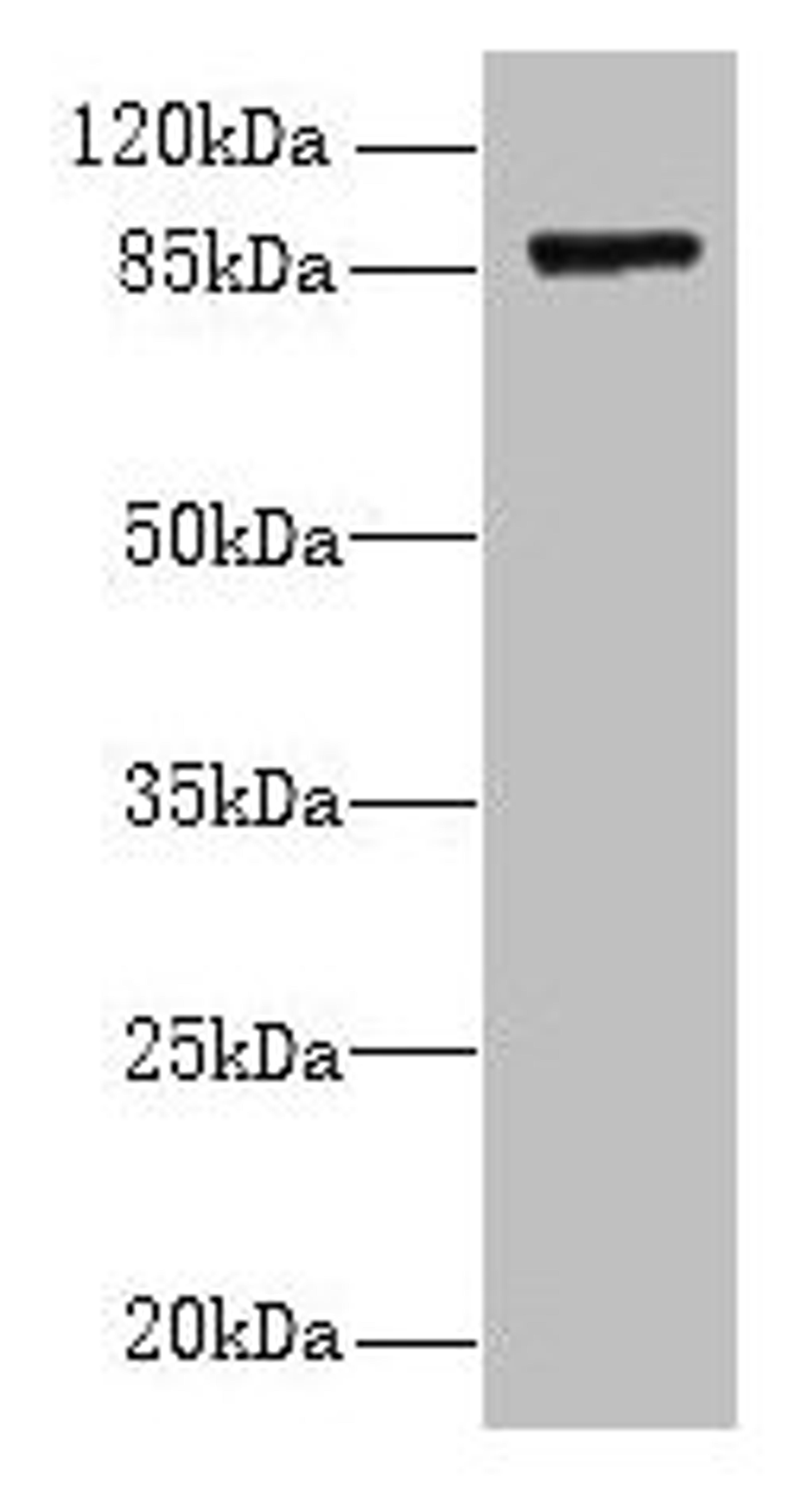 Western blot. All lanes: FSCB antibody at 1.5µg/ml + Mouse liver tissue. Secondary. Goat polyclonal to rabbit IgG at 1/10000 dilution. Predicted band size: 88 kDa. Observed band size: 88 kDa