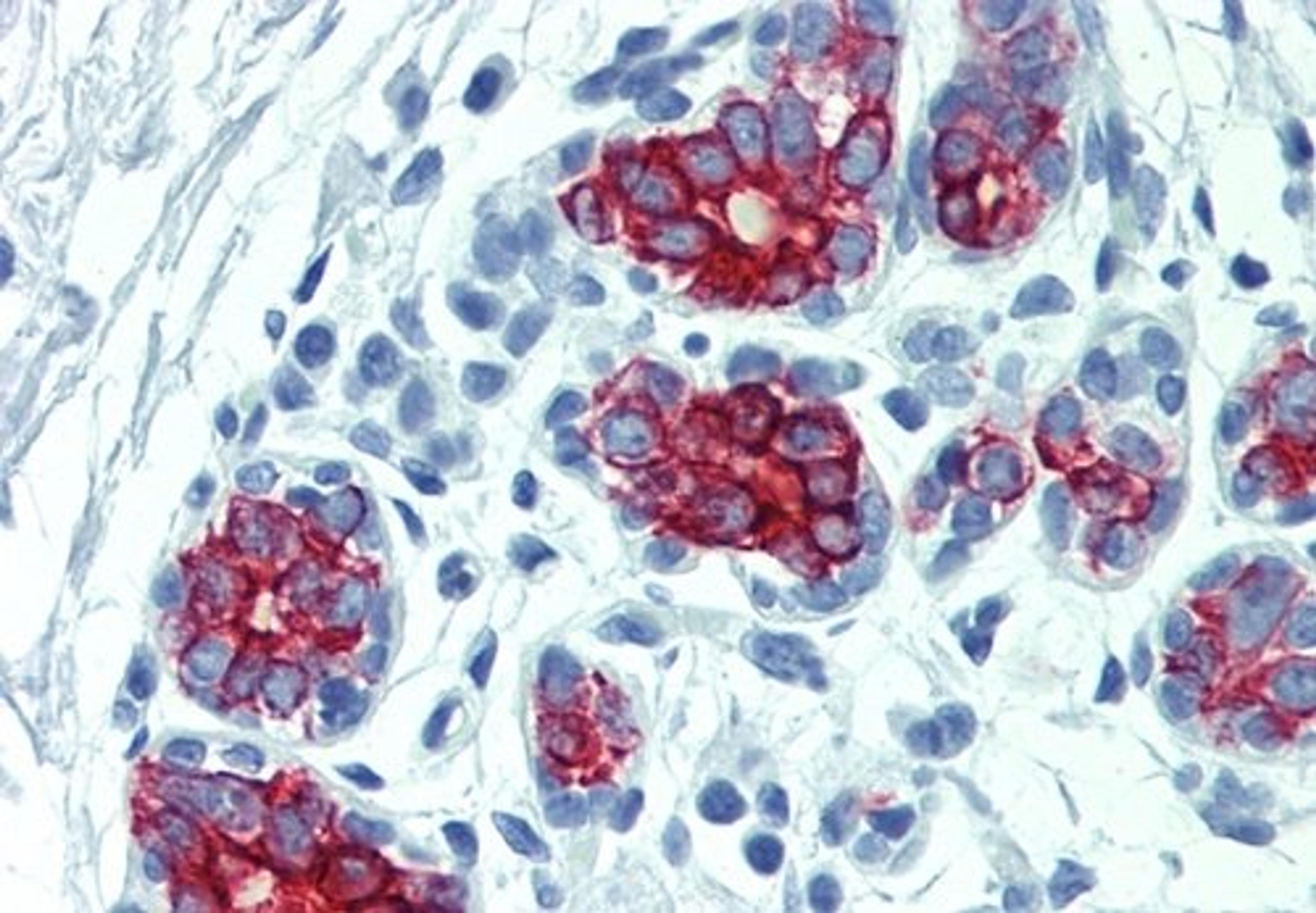 Immunohistochemistry staining of human breast using Cytokeratin 7/17 antibody