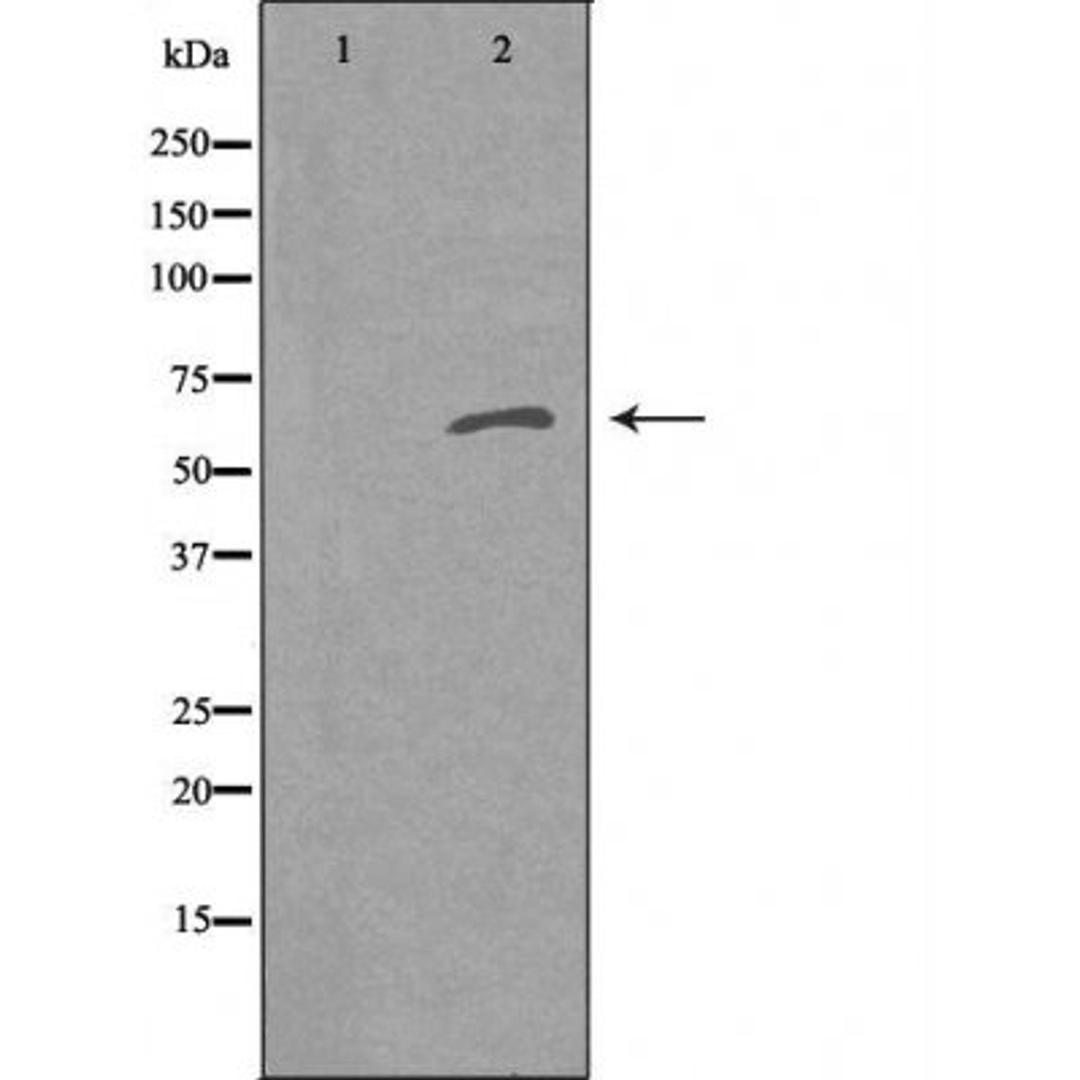 Western blot analysis of K562 cells COLO cells and COS-7 cells using RFTN1 antibody