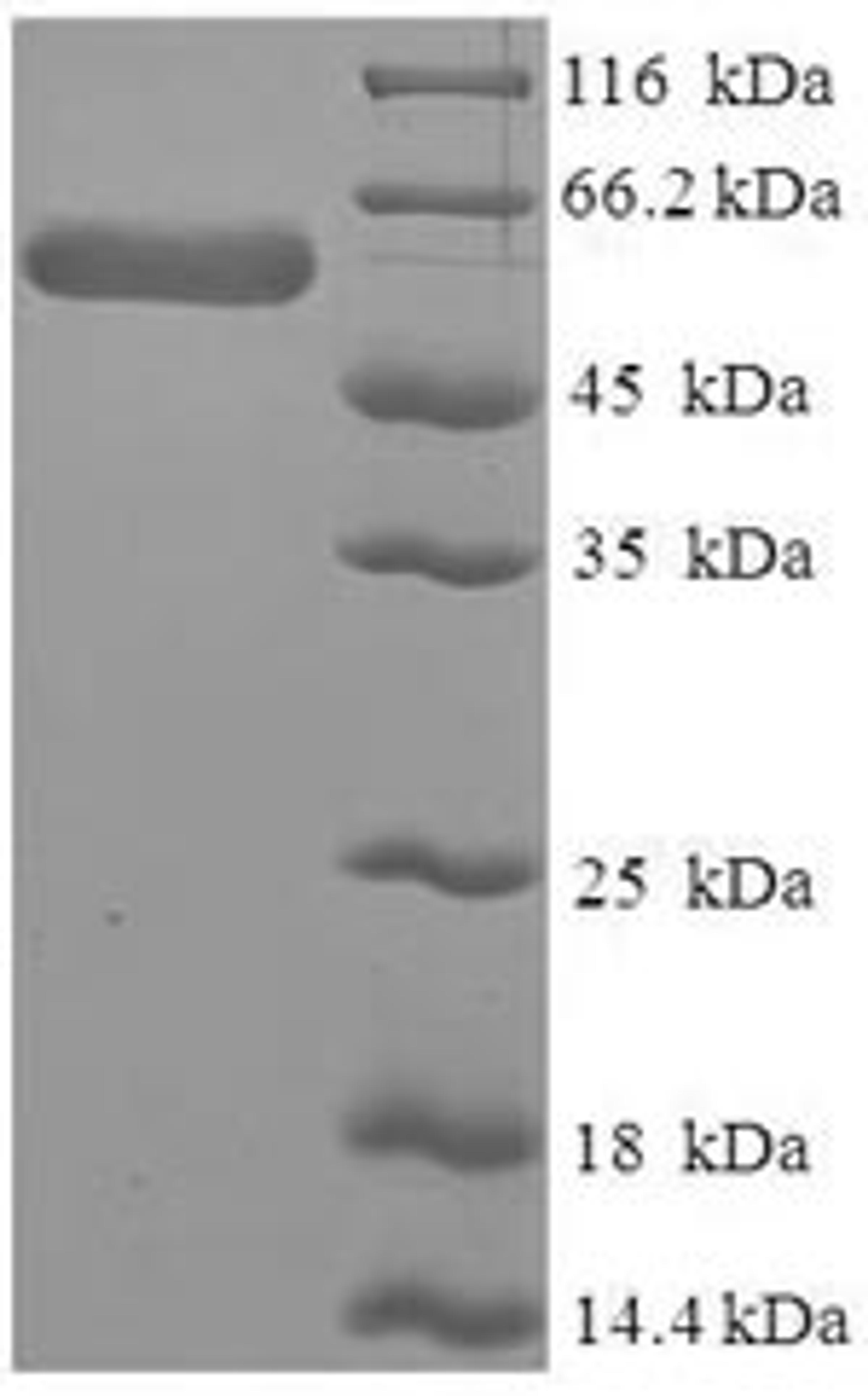 (Tris-Glycine gel) Discontinuous SDS-PAGE (reduced) with 5% enrichment gel and 15% separation gel.