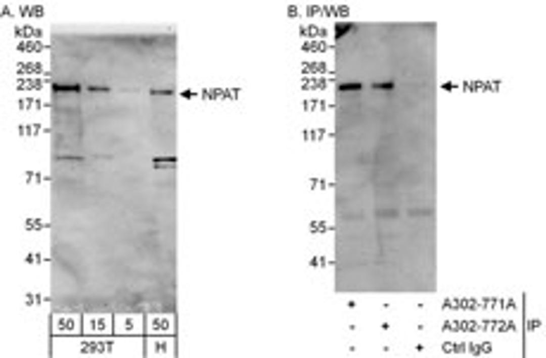 Detection of human NPAT by western blot and immunoprecipitation.