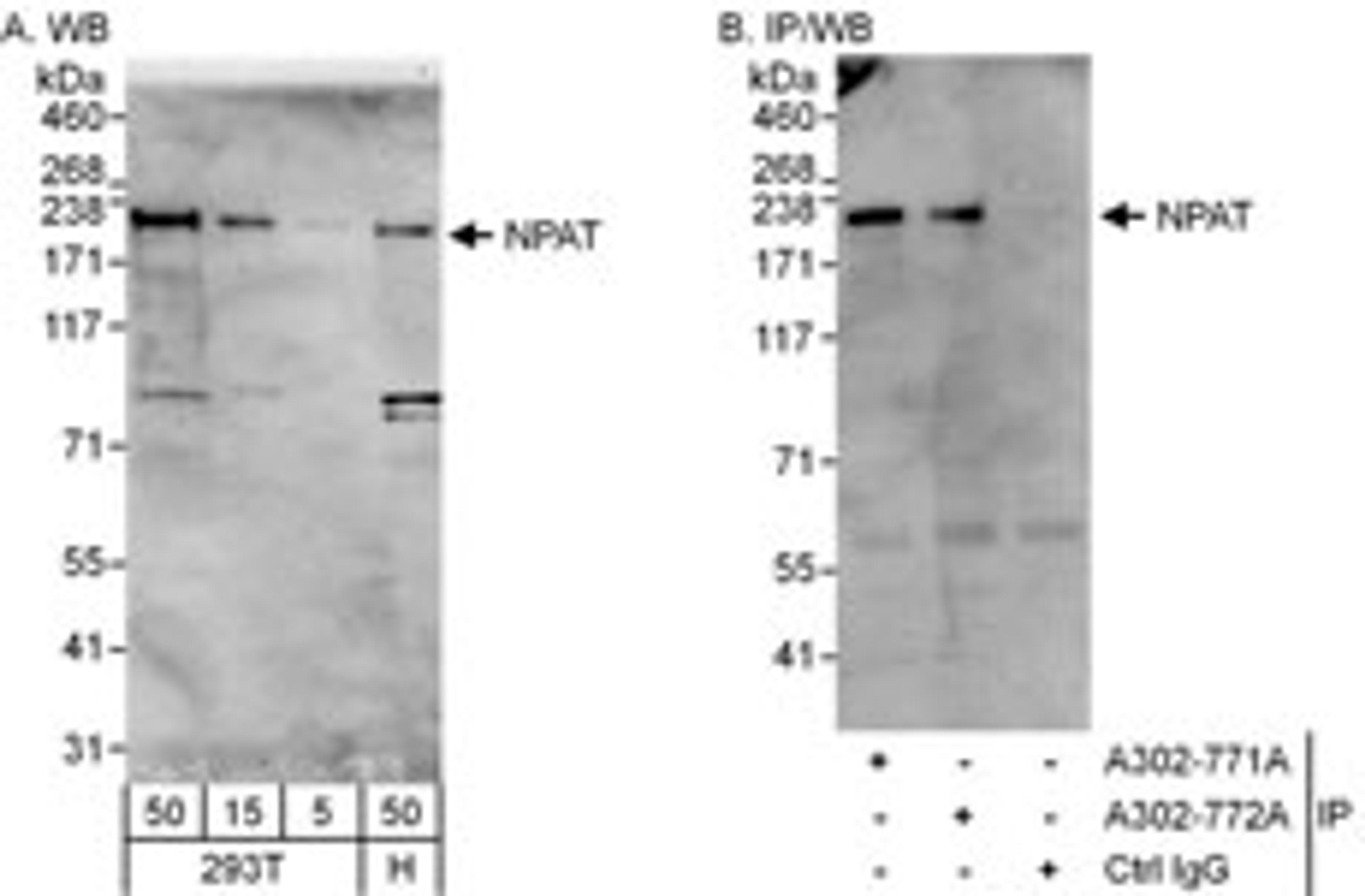 Detection of human NPAT by western blot and immunoprecipitation.