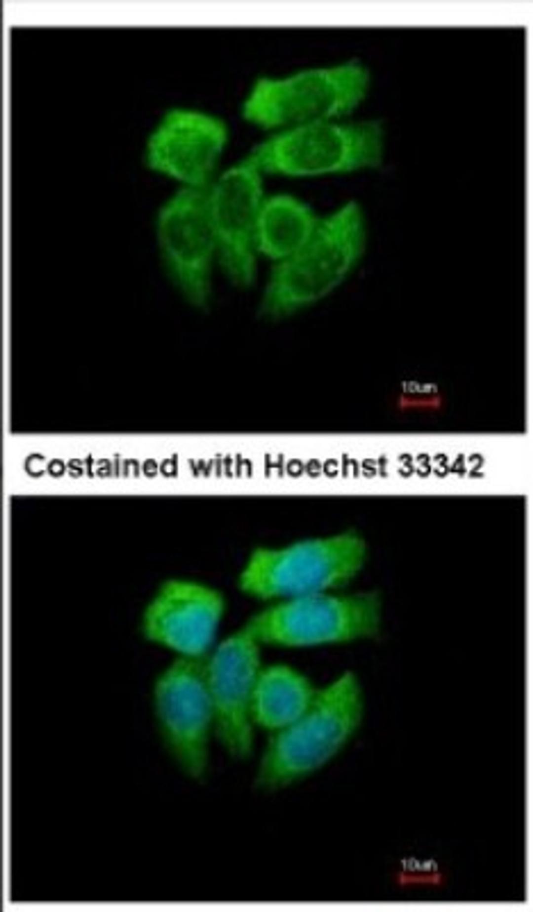 Immunocytochemistry/Immunofluorescence: PAK1 Antibody [NBP2-19680] - Immunofluorescence analysis of methanol-fixed A431, using antibody at 1:500 dilution.