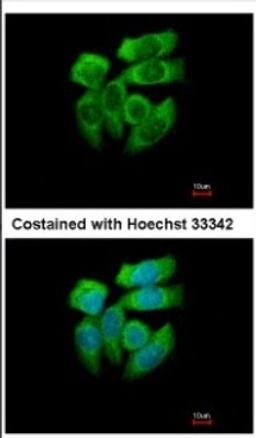 Immunocytochemistry/Immunofluorescence: PAK1 Antibody [NBP2-19680] - Immunofluorescence analysis of methanol-fixed A431, using antibody at 1:500 dilution.