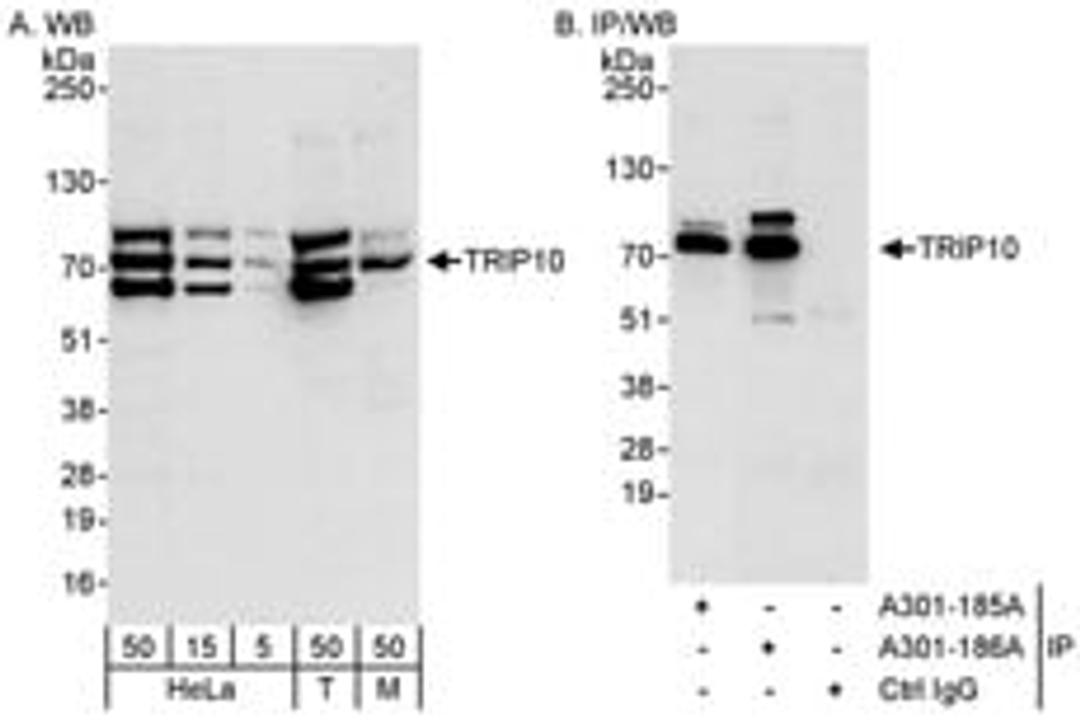 Detection of human and mouse TRIP10 by western blot (h&m) and immunoprecipitation (h).