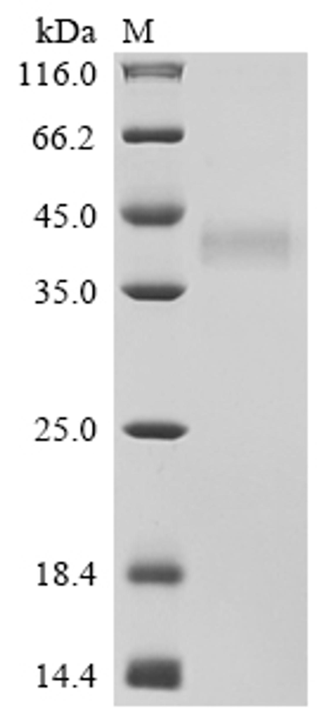 (Tris-Glycine gel) Discontinuous SDS-PAGE (reduced) with 5% enrichment gel and 15% separation gel.