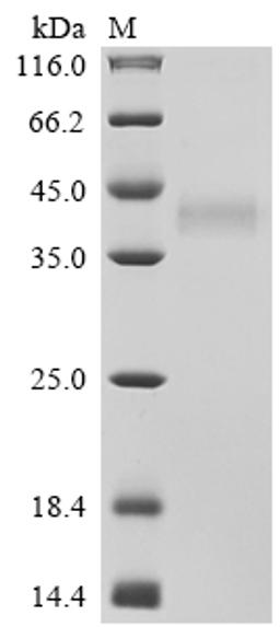 (Tris-Glycine gel) Discontinuous SDS-PAGE (reduced) with 5% enrichment gel and 15% separation gel.