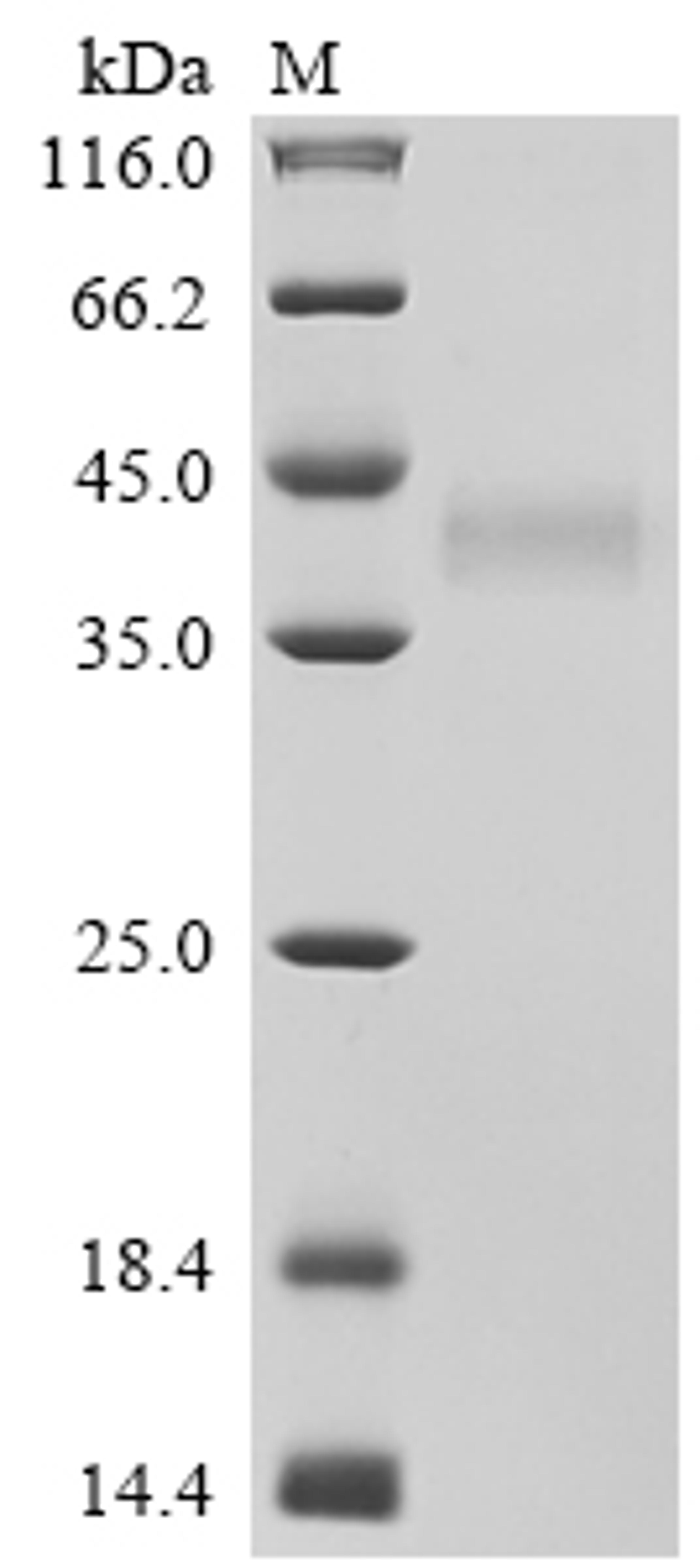 (Tris-Glycine gel) Discontinuous SDS-PAGE (reduced) with 5% enrichment gel and 15% separation gel.
