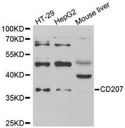 Western blot analysis of extracts of various cell lines using CD207 antibody