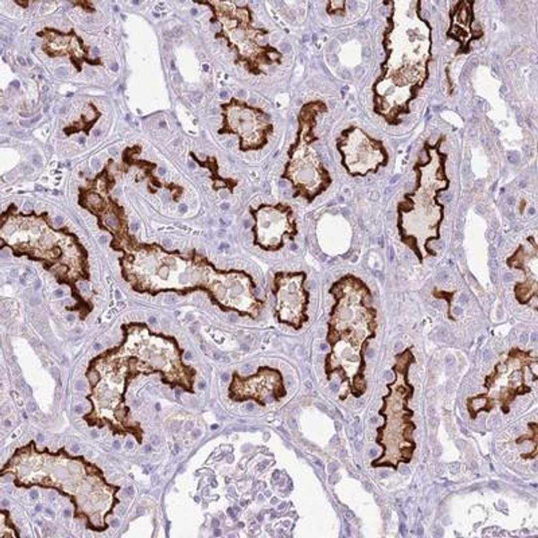 Immunohistochemistry-Paraffin: SLC23A1 Antibody [NBP2-13318] - Staining of human kidney shows strong membranous positivity in cells in tubules.