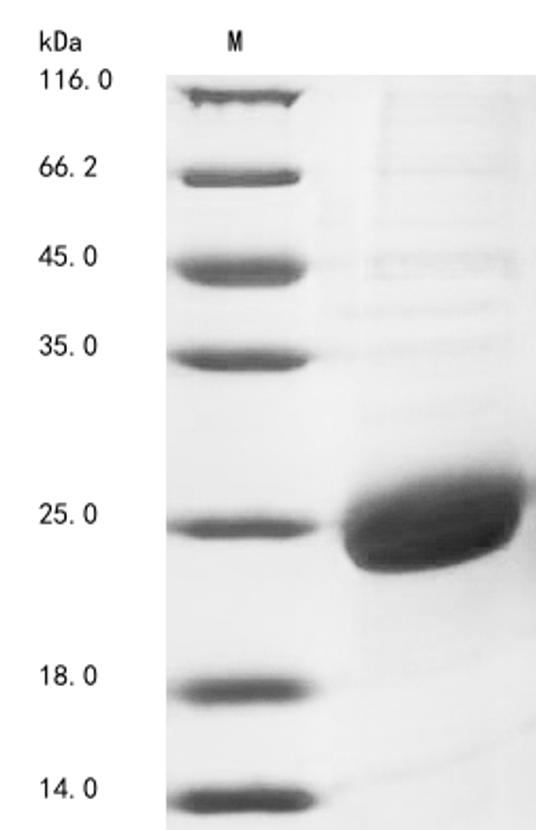 (Tris-Glycine gel) Discontinuous SDS-PAGE (reduced) with 5% enrichment gel and 15% separation gel.