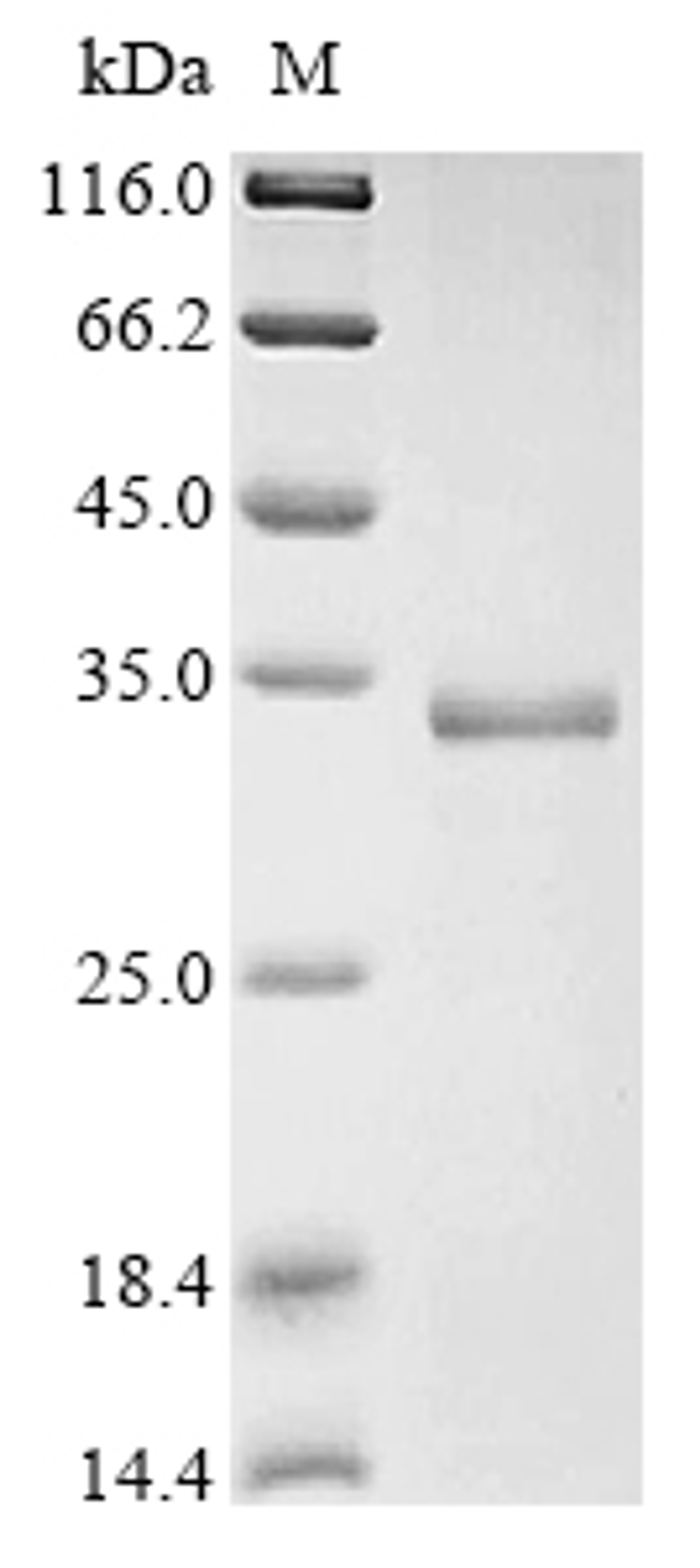 (Tris-Glycine gel) Discontinuous SDS-PAGE (reduced) with 5% enrichment gel and 15% separation gel.