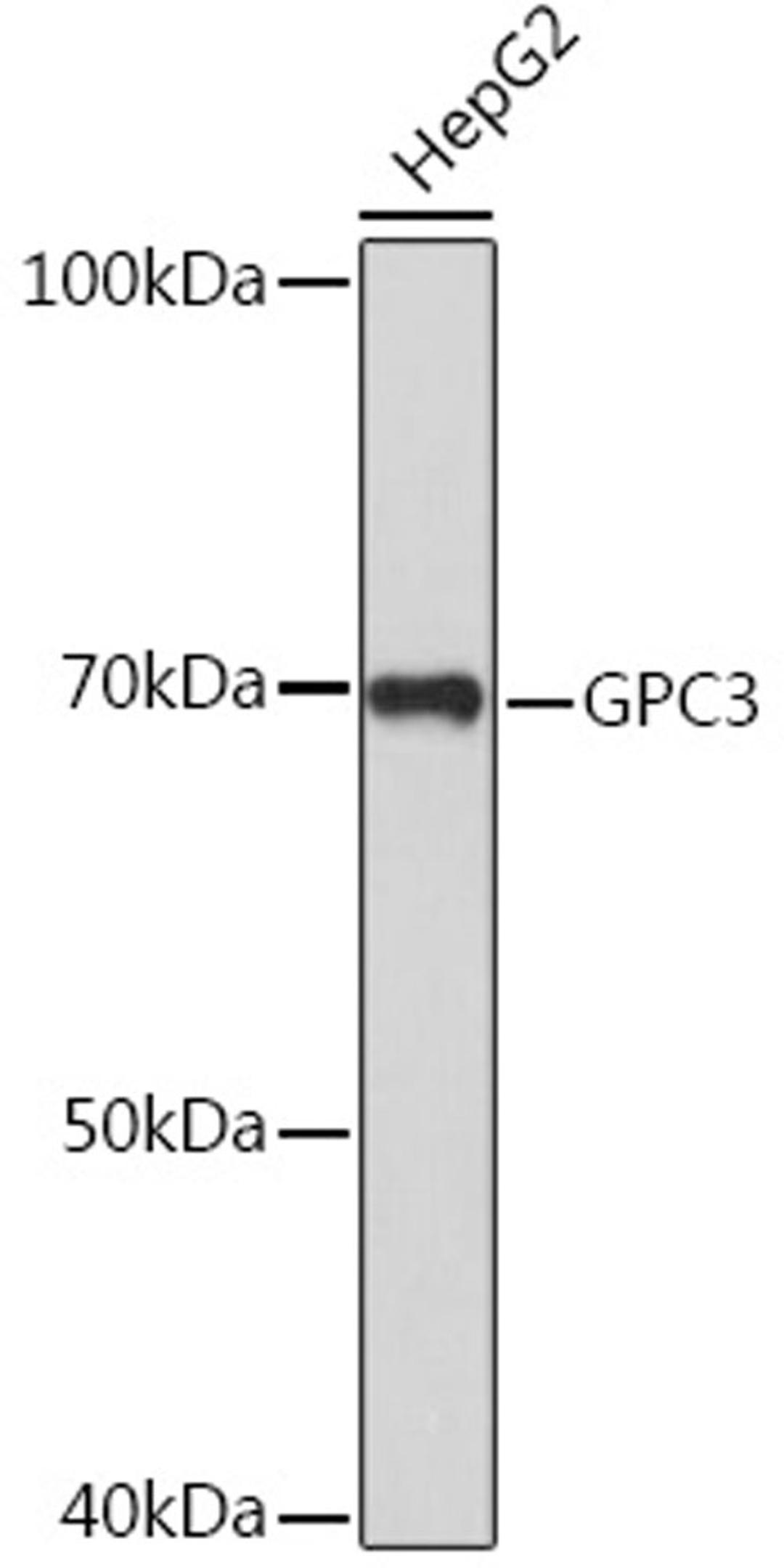 Western blot - GPC3 Rabbit pAb (A12383)