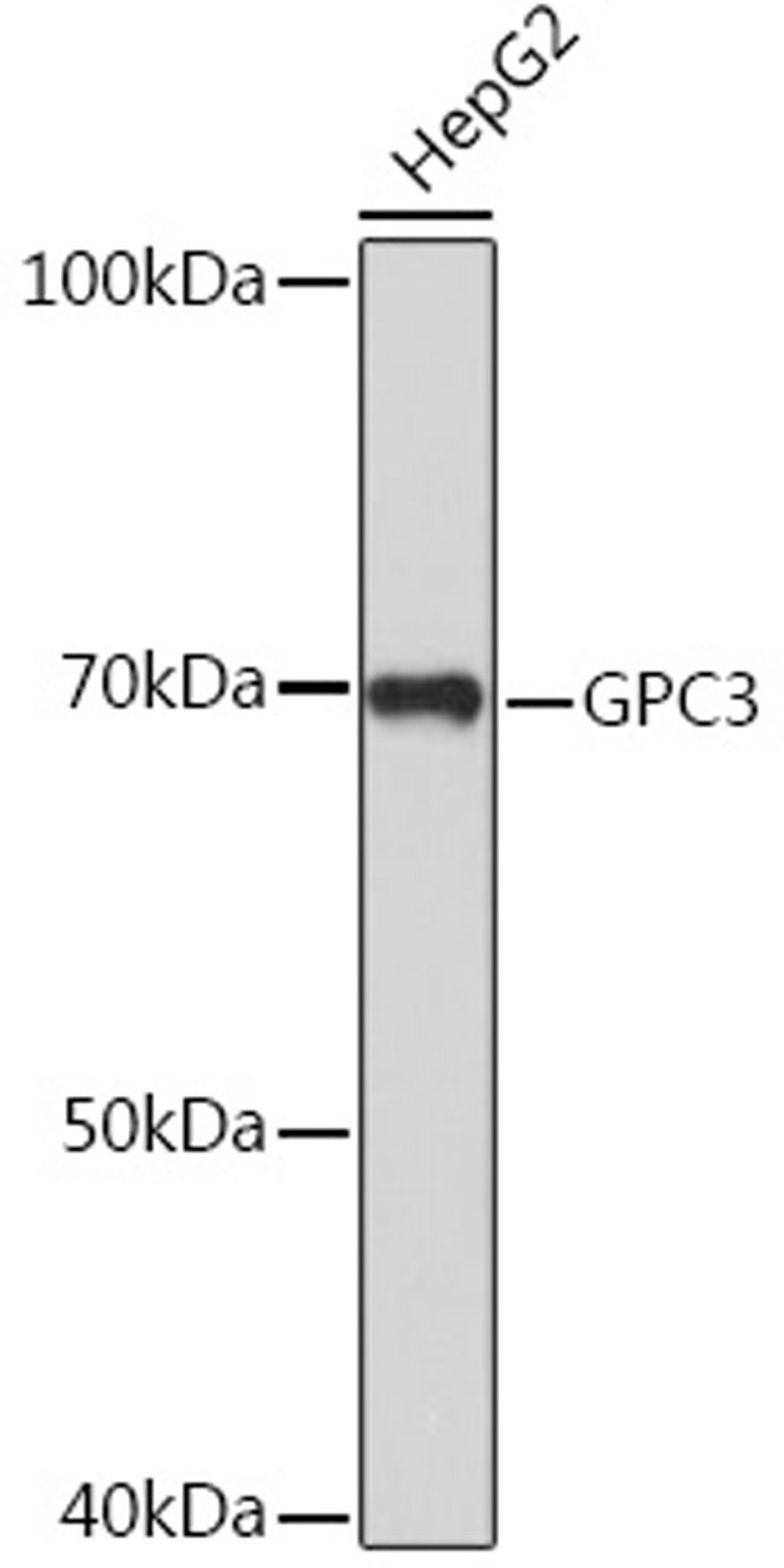 Western blot - GPC3 Rabbit pAb (A12383)