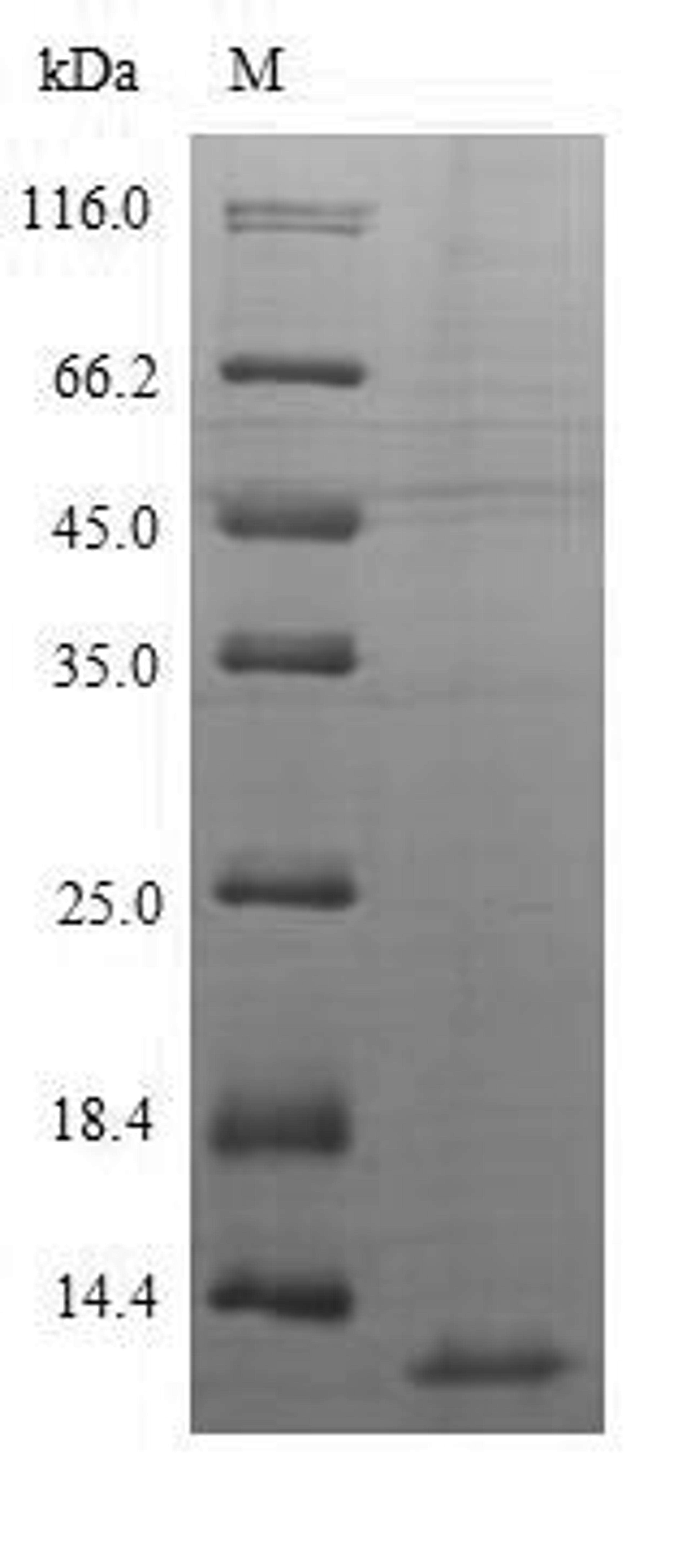 (Tris-Glycine gel) Discontinuous SDS-PAGE (reduced) with 5% enrichment gel and 15% separation gel.
