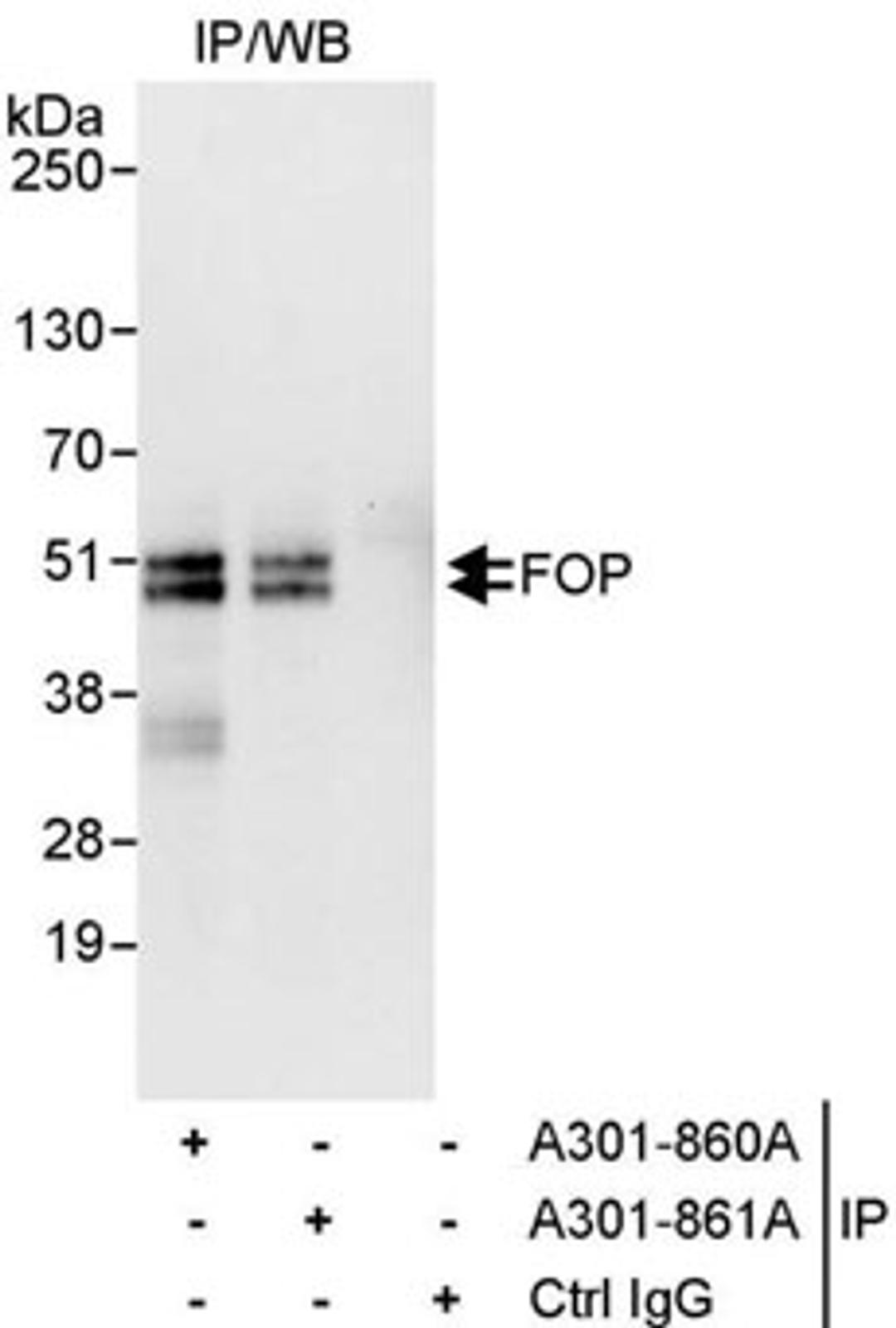 Detection of human FOP by western blot of immunoprecipitates.