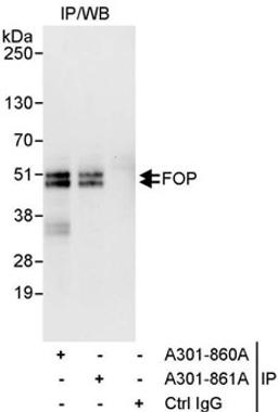 Detection of human FOP by western blot of immunoprecipitates.