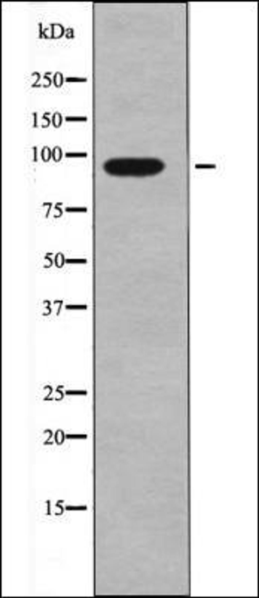 Western blot analysis of NIH-3T3 whole cell lysates using FGFR1/2 -Phospho-Tyr730/733- antibody