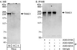 Detection of human TANC1 by western blot and immunoprecipitation.