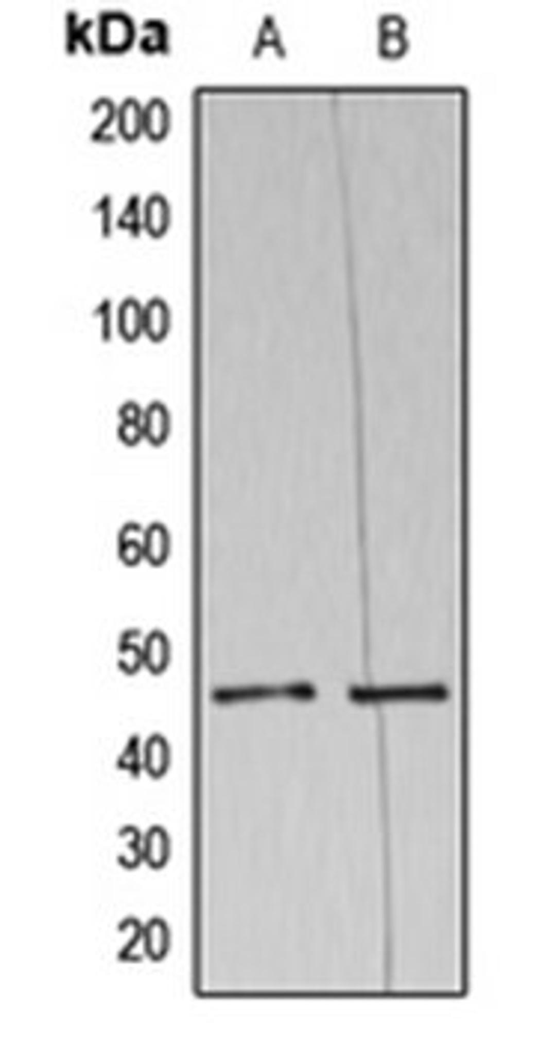 Western blot analysis of HeLa (Lane 1), THP1 (Lane 2) whole cell lysates using AZI2 antibody