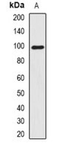 Western blot analysis of A375 (Lane1) whole cell lysates using SMTN antibody