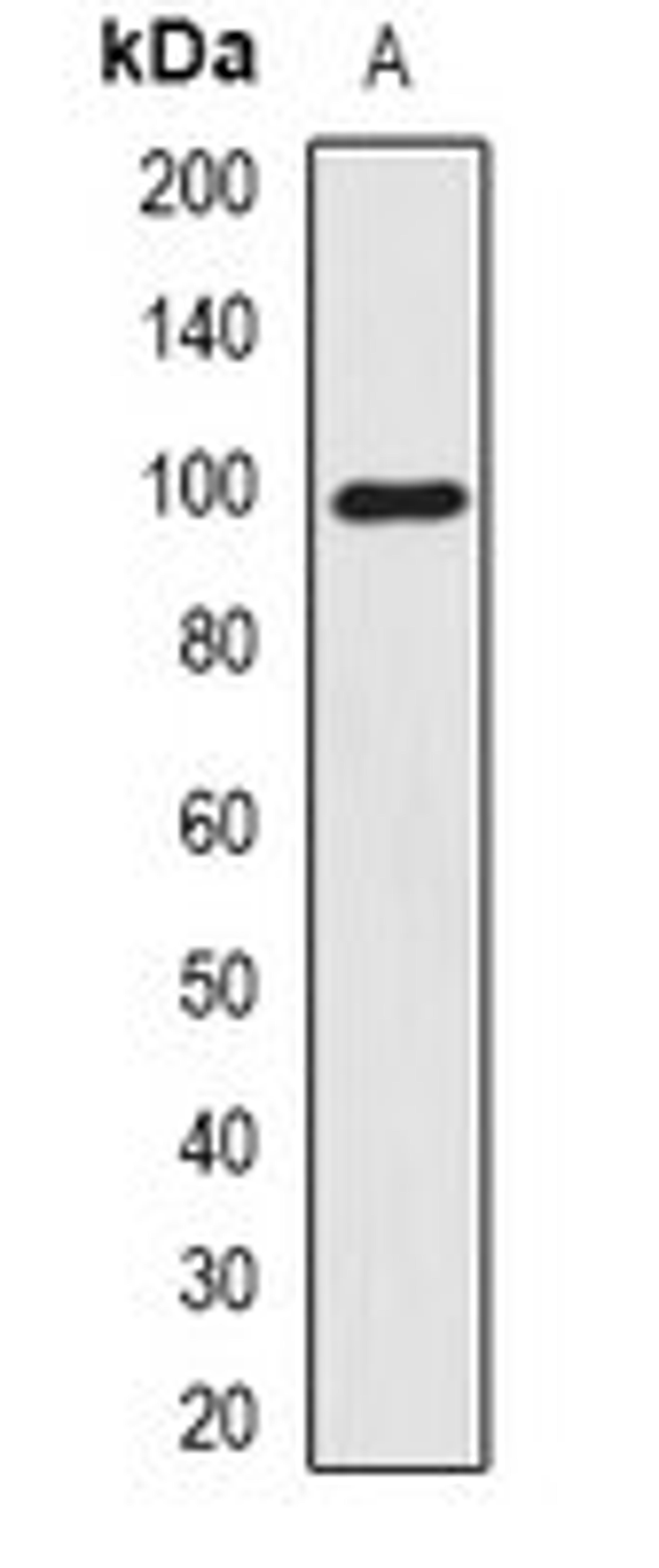 Western blot analysis of A375 (Lane1) whole cell lysates using SMTN antibody