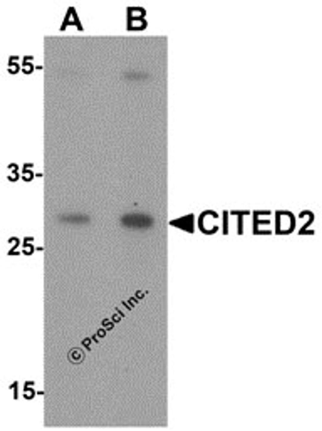 Western blot analysis of CITED2 in Jurkat cell lysate with CITED2 antibody at (A) 1 and (B) 2 &#956;g/mL.