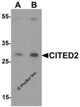 Western blot analysis of CITED2 in Jurkat cell lysate with CITED2 antibody at (A) 1 and (B) 2 &#956;g/mL.